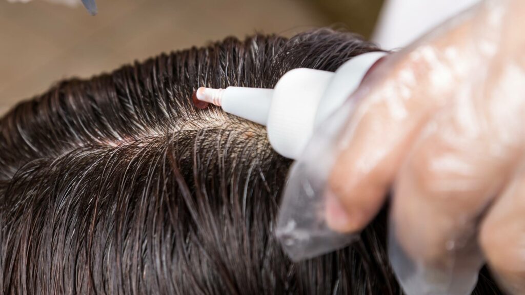An individual applies hair dye to the roots of dark hair using an applicator bottle, with gloved hands visible, ensuring gentle care of the scalp throughout the process.