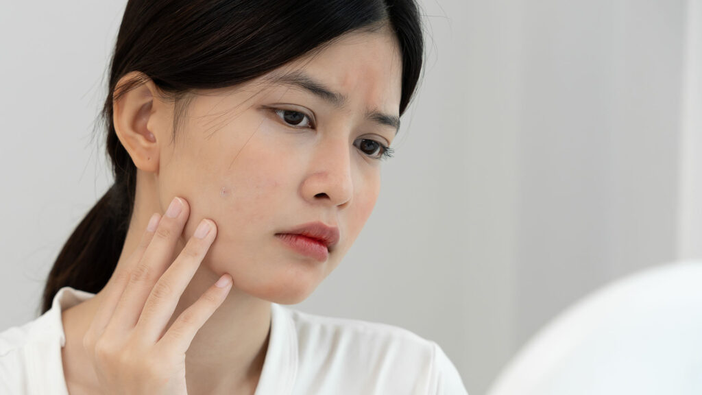 A young woman examines a spot on her cheek in a mirror as the evenings close in.